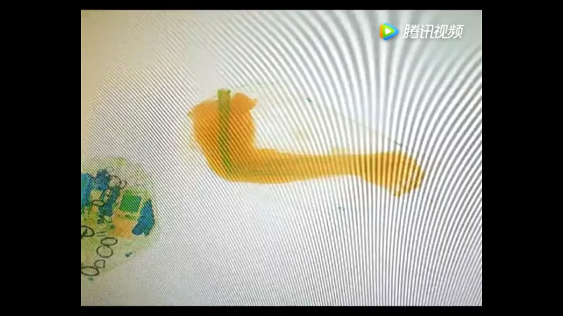 人間の腕を運ぶ理由