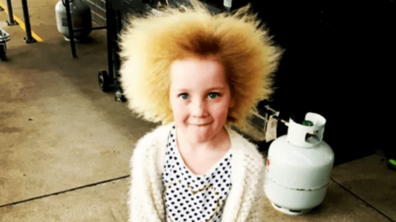 髪の毛の奇病｢クシでとかせない毛髪症候群｣の少女