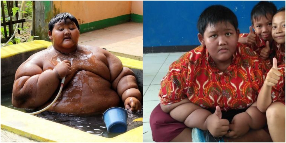 世界一太った少年ダイエット成功