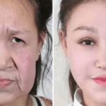 老化の奇病を患った少女が整形手術