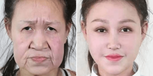 老化の奇病を患った少女が整形手術