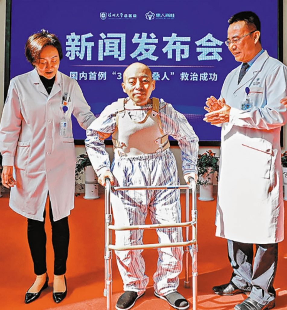 28年間奇病で体が折れ曲がった中国人