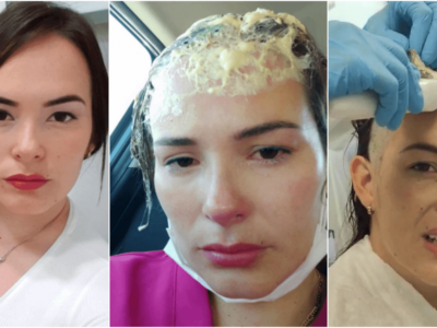 不審者が美人の頭に接着剤キャップ事件