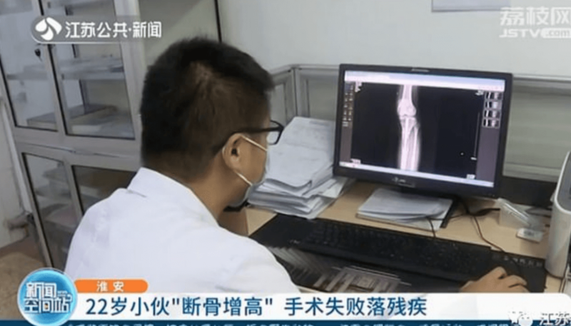 身長を伸ばす骨延長手術の失敗で障害が残った中国人男性