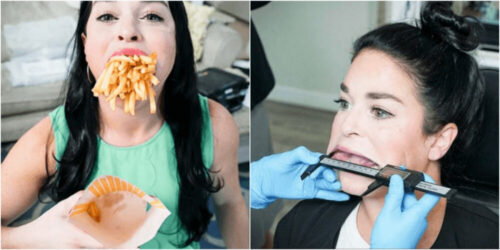 世界一大きな口の女性をギネス認定