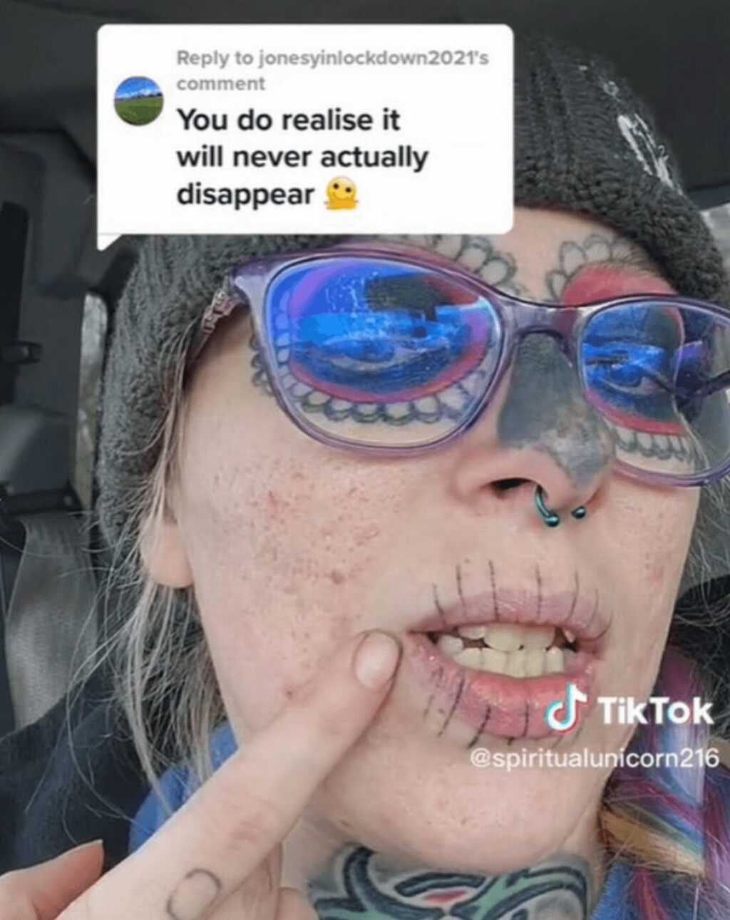 顔面のドクロタトゥーの除去を決意した女性
