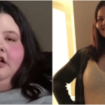 体重300kgの肥満女性がダイエット成功
