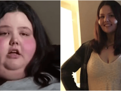 体重300kgの肥満女性がダイエット成功