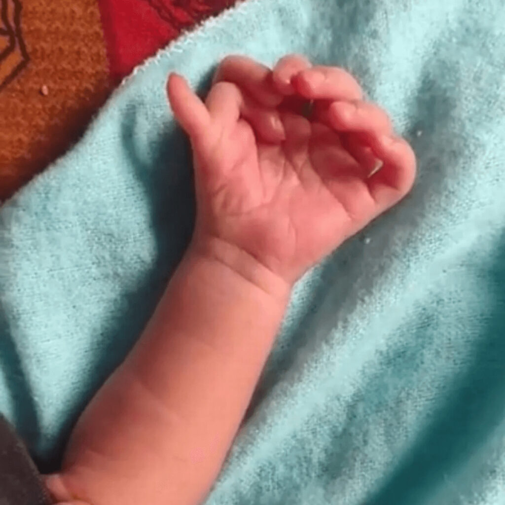 26本指の多指症赤ちゃんは神様の生まれ変わり!?家族は大喜び!