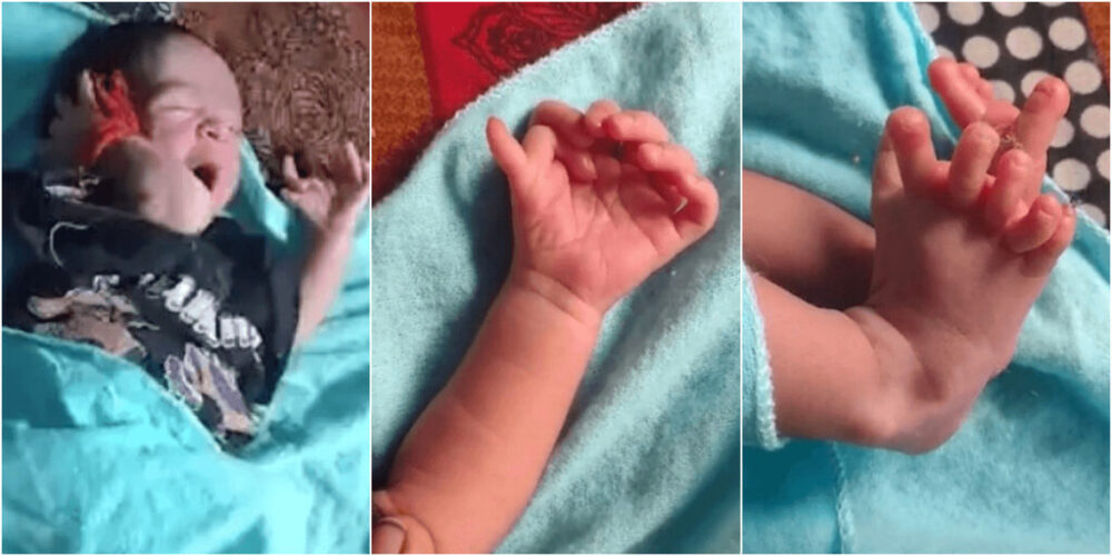 26本指の多指症赤ちゃんは神様の生まれ変わり!?家族は大喜び!