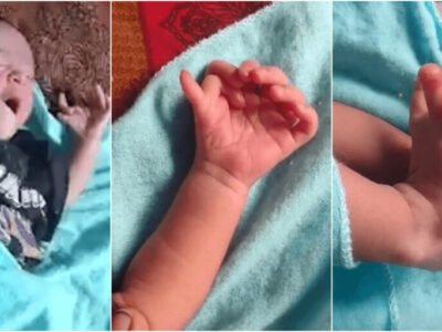 26本指の多指症赤ちゃんは神様の生まれ変わり