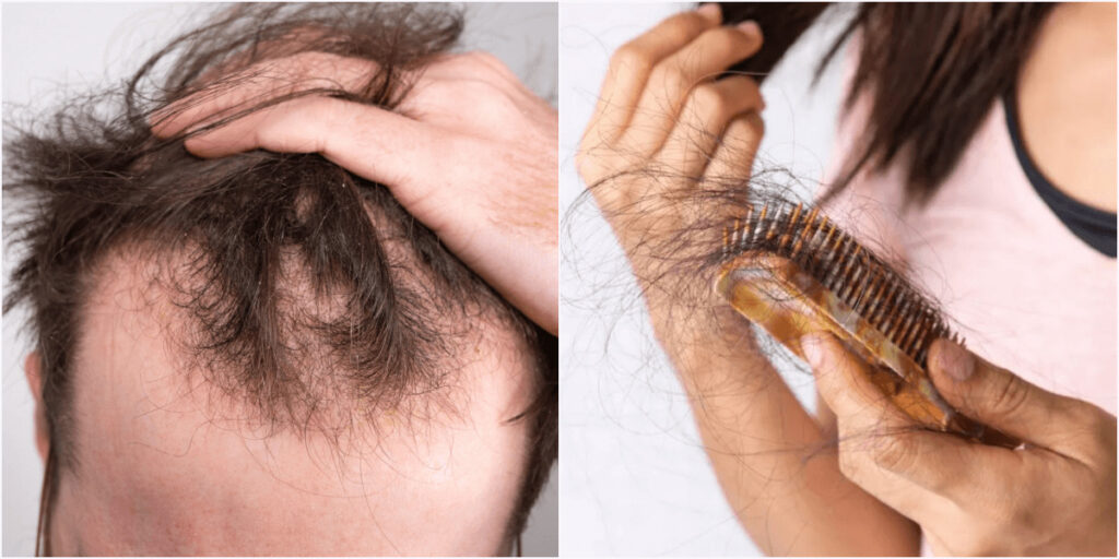 「髪の毛が抜ける夢」の意味を専門家が解説