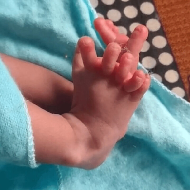 26本指の多指症赤ちゃんは神様の生まれ変わり