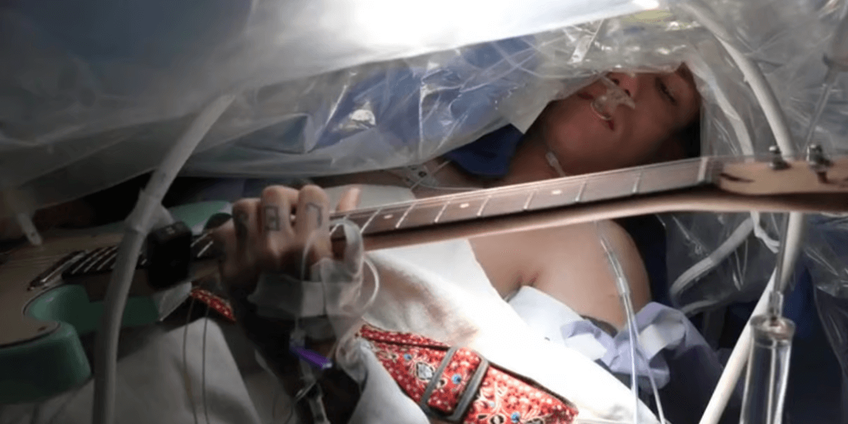 脳腫瘍の摘出手術中にギターを演奏する男の動画